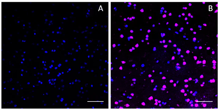 Alexa Fluor® 647 anti-c-Fos Phospho (Ser32) (for IHC and ICC)