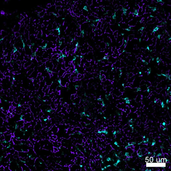 Alexa Fluor® 647 anti-Cytokeratin (pan reactive) - Image 4