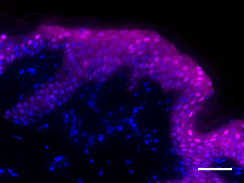 Alexa Fluor® 647 anti-Galectin-7