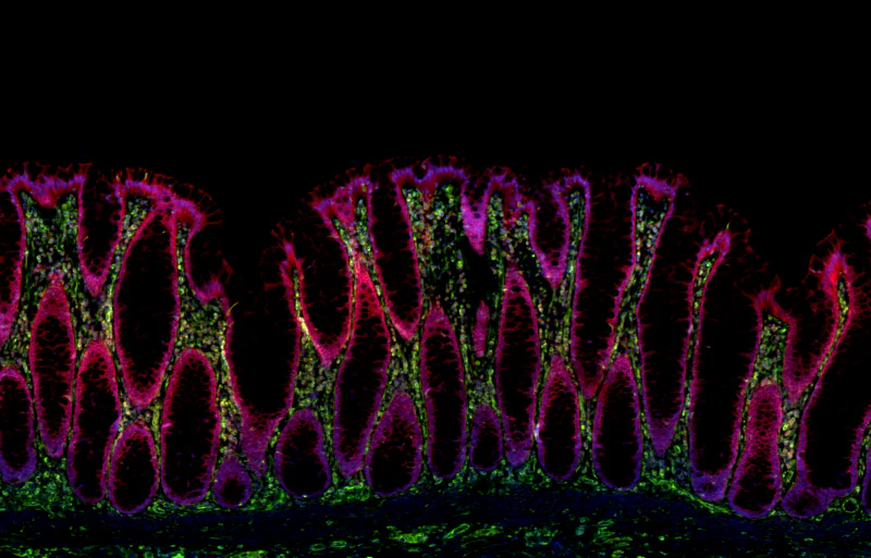 Alexa Fluor® 647 anti-human CD171 (L1CAM) - Image 2
