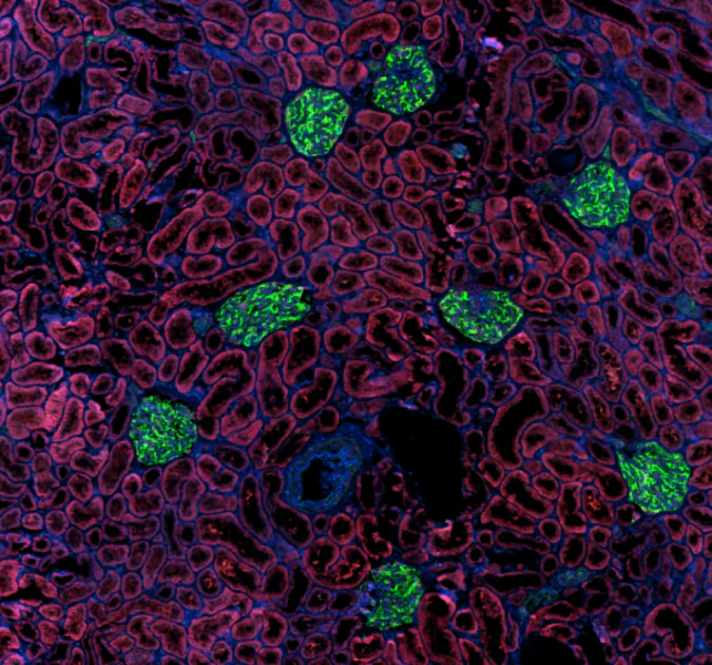 Alexa Fluor® 647 anti-human CD243 (MDR-1) - Image 2
