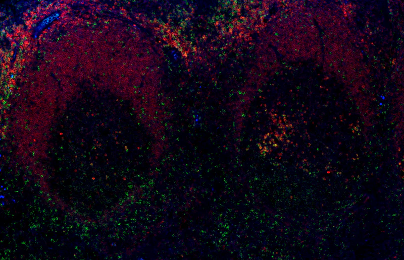Alexa Fluor® 647 anti-human CD79a (Igα) - Image 2