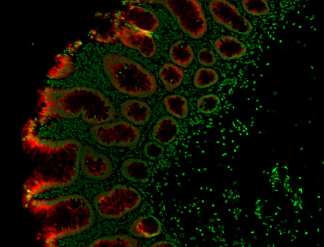 Alexa Fluor® 647 anti-human Galectin-4