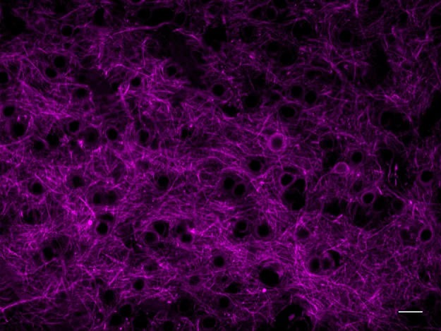 Alexa Fluor® 647 anti-MAP2