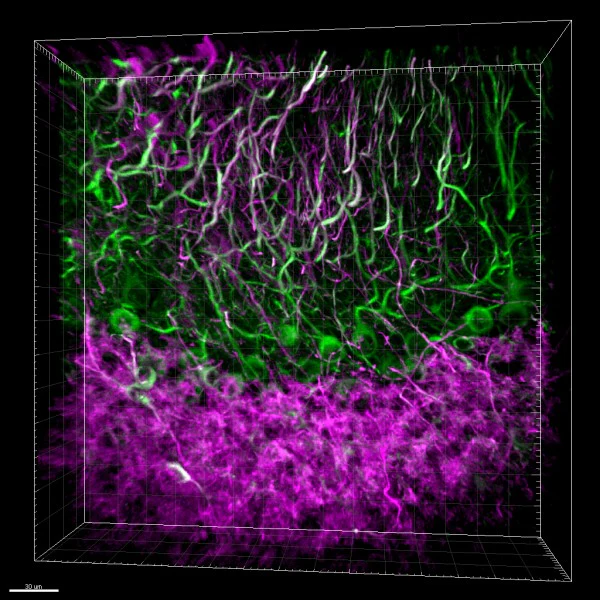 Alexa Fluor® 647 anti-MAP2 - Image 3