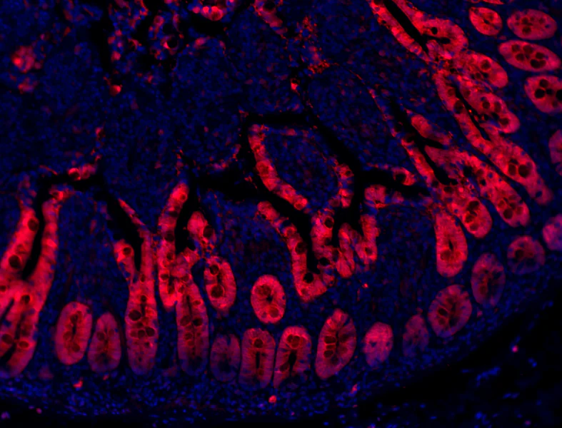 Alexa Fluor® 647 anti-mouse/human Mac-2 (Galectin-3) - Image 2