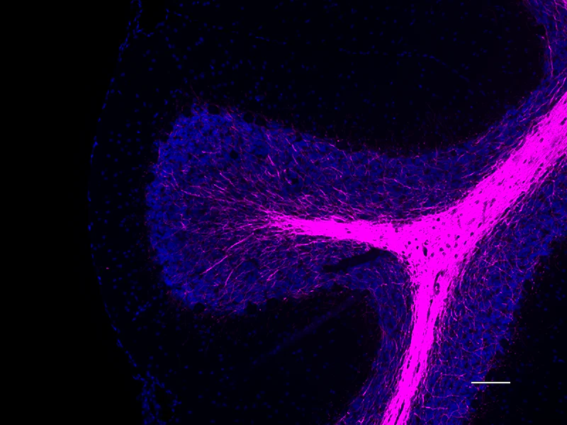 Alexa Fluor® 647 anti-Myelin Basic Protein - Image 2