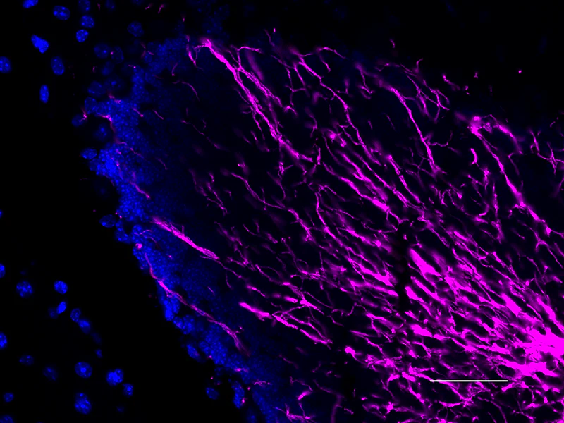 Alexa Fluor® 647 anti-Myelin Basic Protein - Image 3