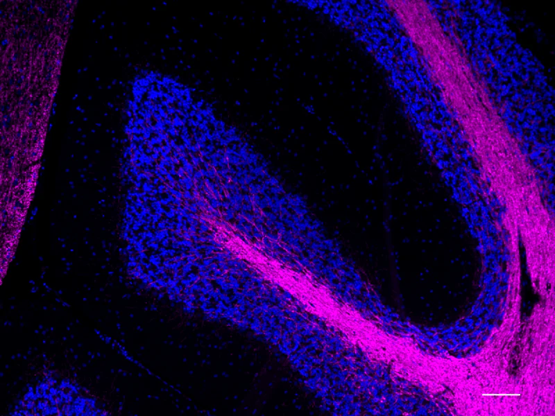 Alexa Fluor® 647 anti-Myelin CNPase - Image 2