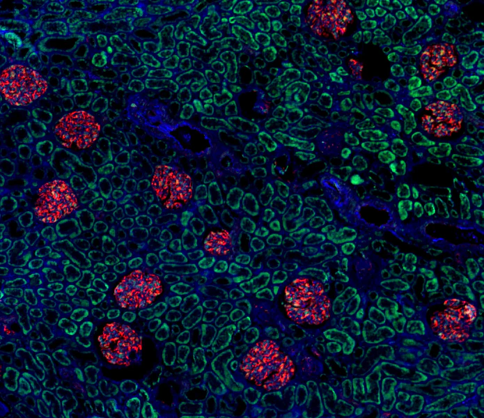 Alexa Fluor® 647 anti-Nestin - Image 2