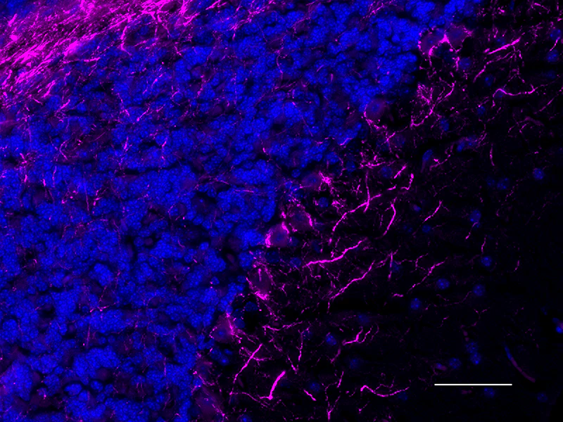 Alexa Fluor® 647 anti-Neurofilament H (NF-H), Phosphorylated - Image 3