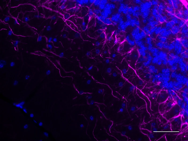 Alexa Fluor® 647 anti-NF H & M (NF-H/NF-M), Phosphorylated - Image 4