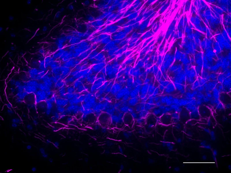 Alexa Fluor® 647 anti NF-H/NF-M, Hypophosphorylated - Image 2