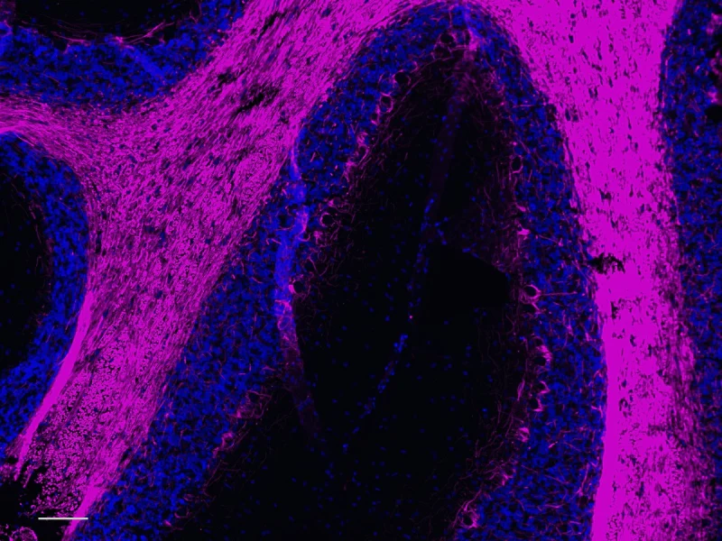 Alexa Fluor® 647 anti NF-H/NF-M, Hypophosphorylated - Image 5