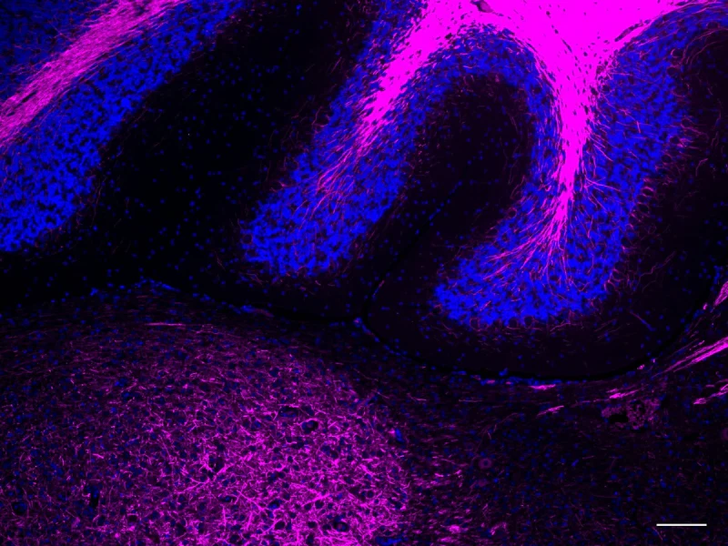 Alexa Fluor® 647 anti NF-H/NF-M, Hypophosphorylated - Image 6