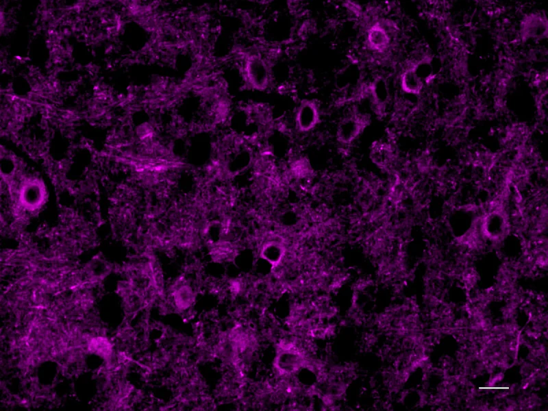 Alexa Fluor® 647 anti-NSE - Image 2
