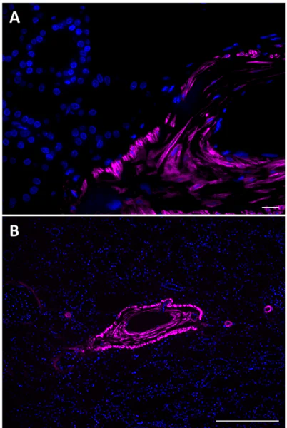 Alexa Fluor® 647 anti-α Smooth Muscle Actin