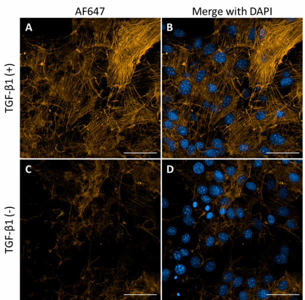 Alexa Fluor® 647 anti-α Smooth Muscle Actin - Image 2