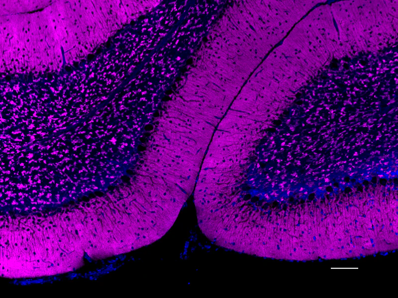 Alexa Fluor® 647 anti-Synapsin I/II/III - Image 2