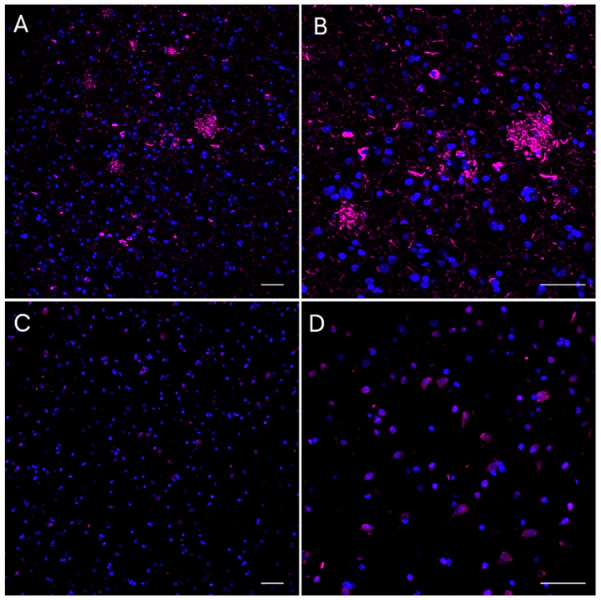 Alexa Fluor® 647 anti-Tau Phospho (Thr231)
