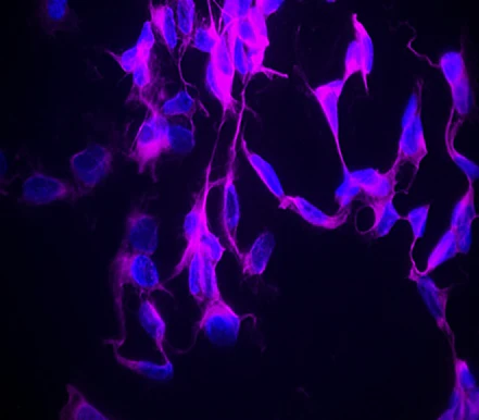 Alexa Fluor® 647 anti-Tubulin β 3 (TUBB3)