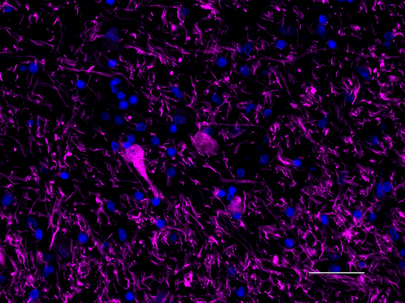 Alexa Fluor® 647 anti-Tyrosine Hydroxylase - Image 2