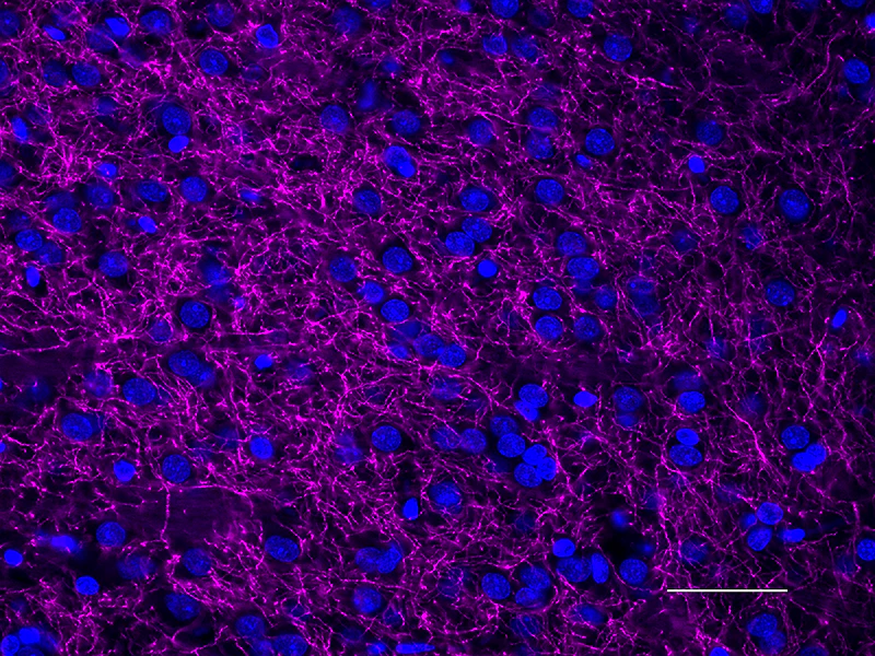 Alexa Fluor® 647 anti-Tyrosine Hydroxylase - Image 3