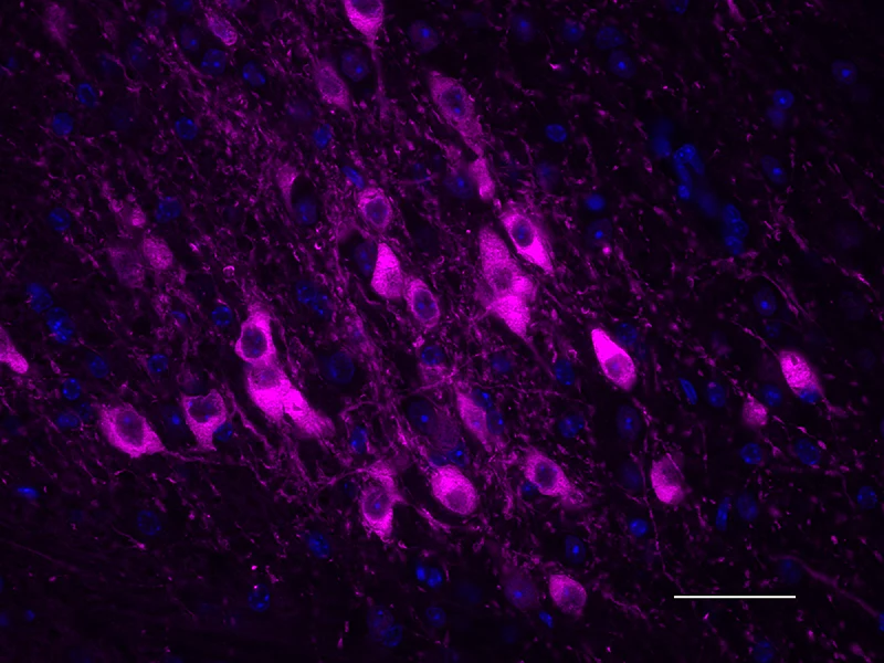 Alexa Fluor® 647 anti-Tyrosine Hydroxylase - Image 4