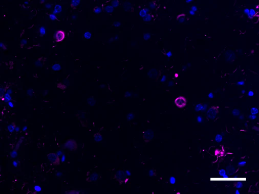 Alexa Fluor® 647 anti-Ubiquitin