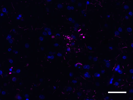 Alexa Fluor® 647 anti-Ubiquitin - Image 2