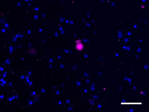 Alexa Fluor® 647 anti-Ubiquitin - Image 3