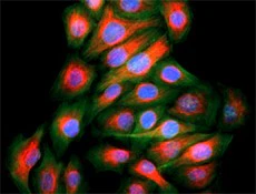 Alexa Fluor® 647 anti-Vimentin