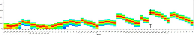 CD23 Monoclonal Antibody (B3B4), NovaFluor Yellow 660, eBioscience
