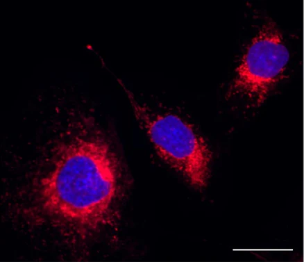 Endoplasmic Reticulum Probe Red