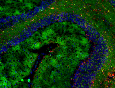 Flash Phalloidin™ Green 488 - Image 2