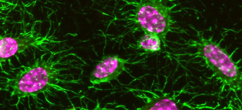 Flash Phalloidin™ Green 488 - Image 4