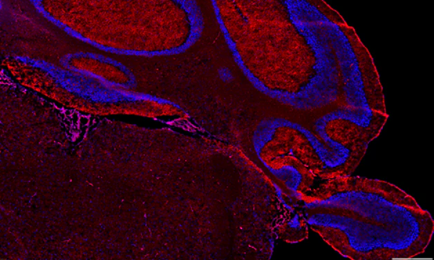 Flash Phalloidin™ Red 594 - Image 2