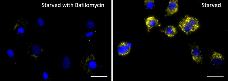 Lysosome Probe Orange