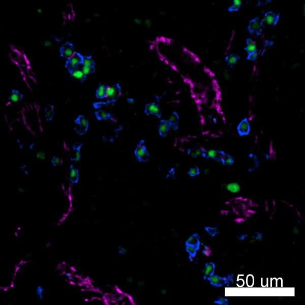 PE anti-IRF4 - Image 2