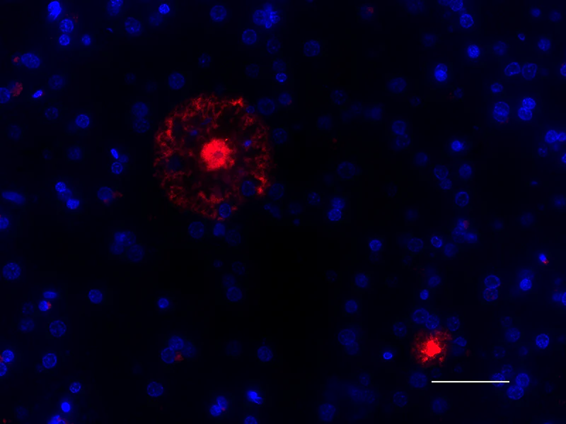 Spark YG™ 570 anti-β-Amyloid, 1-16