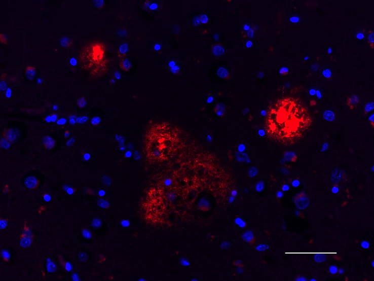Spark YG™ 570 anti-β-Amyloid, 17-24