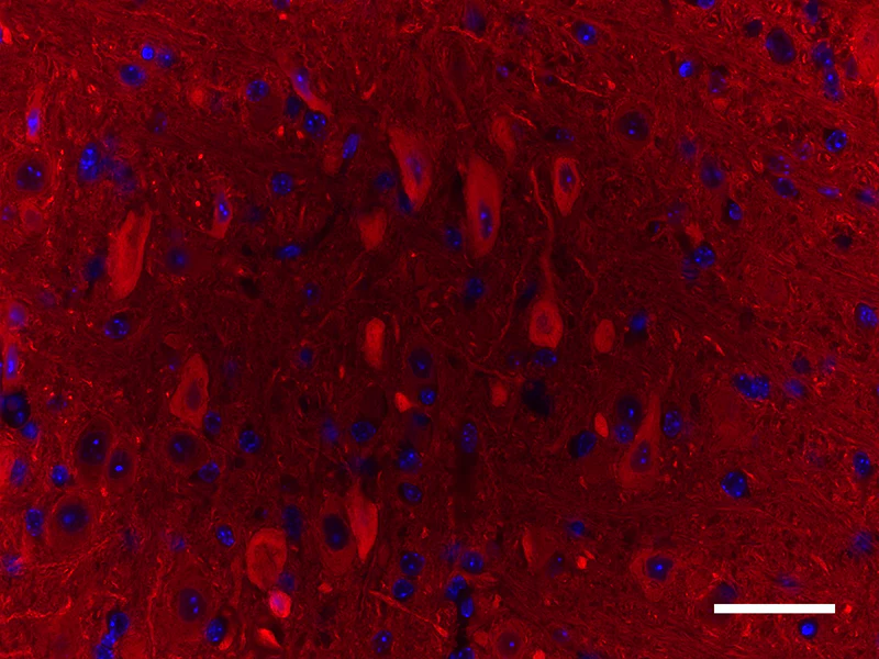 Spark YG™ 570 anti-NSE - Image 2