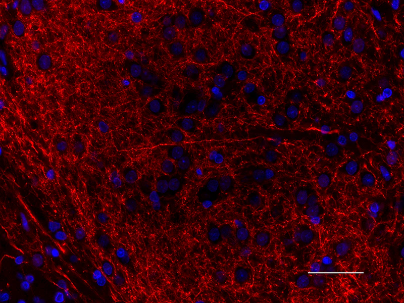Spark YG™ 570 anti-Tyrosine Hydroxylase