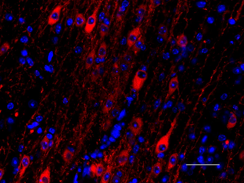 Spark YG™ 570 anti-Tyrosine Hydroxylase - Image 2